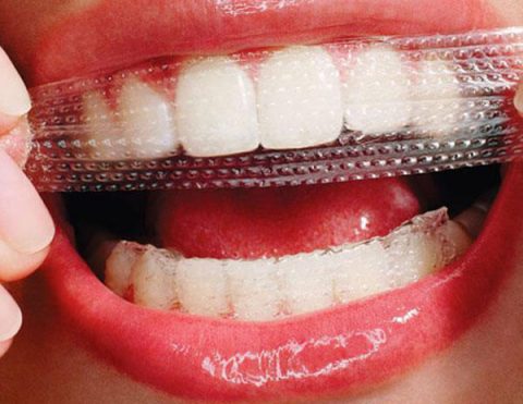 نوار سفید کننده دندان