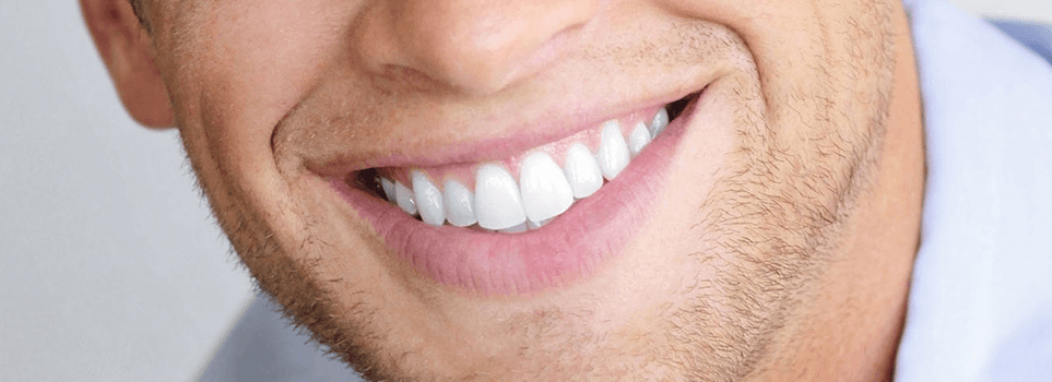 آنالیز لبخند در دندانپزشکی