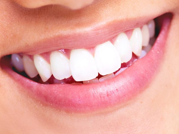 چرا زیبایی دندانها ضروری است؟