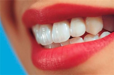 رویاندن دندان سانترال
