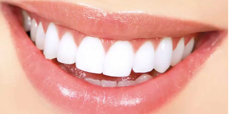 لثه مهمترین بخش برای سلامت دهان و دندان