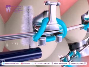 مسواک بین دندانی