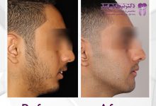 نمونه ارتودنسی ثابت شماره 67