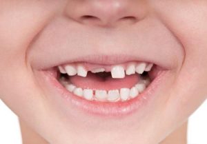 دوره تکامل دندانی از حین تولد تا 18 سالگی